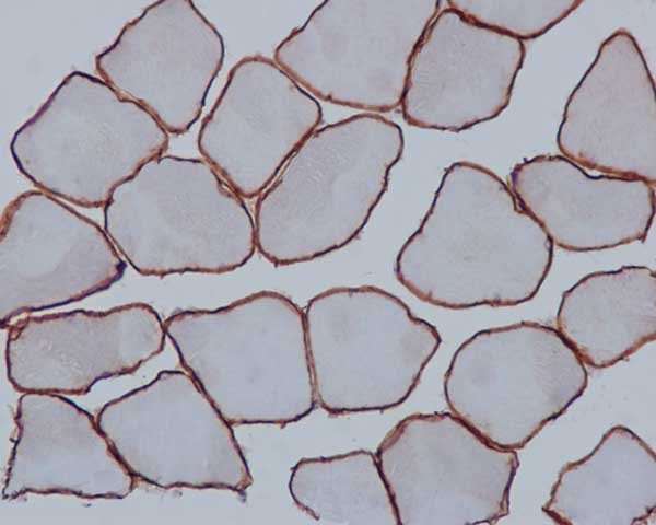 Immunohistochemistry (Formalin/PFA-fixed paraffin-embedded sections) - Anti-alpha Sarcoglycan antibody [EPR14773] - BSA and Azide free (AB240307), expandable thumbnail