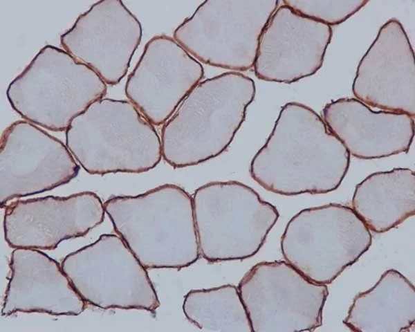 Immunohistochemistry (Formalin/PFA-fixed paraffin-embedded sections) - Anti-alpha Sarcoglycan antibody [EPR14773] - BSA and Azide free (AB240307)