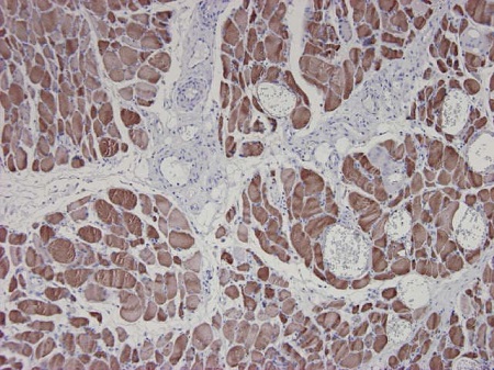 Immunohistochemistry (Formalin/PFA-fixed paraffin-embedded sections) - Anti-Alpha Skeletal Muscle Actin antibody [3B3] - N-terminal (AB218975), expandable thumbnail