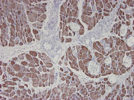 Immunohistochemistry (Formalin/PFA-fixed paraffin-embedded sections) - Anti-Alpha Skeletal Muscle Actin antibody [3B3] - N-terminal - Cytoskeleton Marker (AB218975)