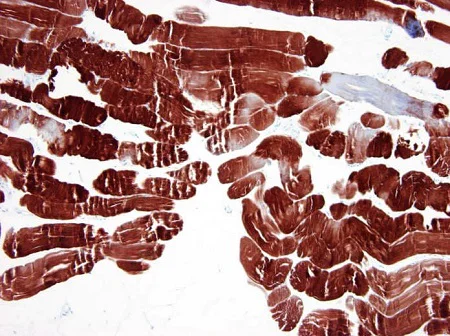 Immunohistochemistry (Formalin/PFA-fixed paraffin-embedded sections) - Anti-Alpha Skeletal Muscle Actin antibody [3B3] - N-terminal - Cytoskeleton Marker (AB218975)
