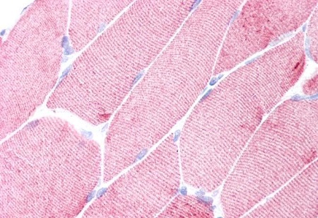 Immunohistochemistry (Formalin/PFA-fixed paraffin-embedded sections) - Anti-Alpha Skeletal Muscle Actin antibody [3B3] - N-terminal (AB218975), expandable thumbnail