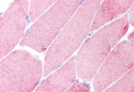 Immunohistochemistry (Formalin/PFA-fixed paraffin-embedded sections) - Anti-Alpha Skeletal Muscle Actin antibody [3B3] - N-terminal - Cytoskeleton Marker (AB218975)