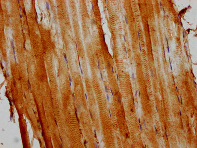 Immunohistochemistry (Formalin/PFA-fixed paraffin-embedded sections) - Anti-Alpha Skeletal Muscle Actin antibody (AB235928), expandable thumbnail
