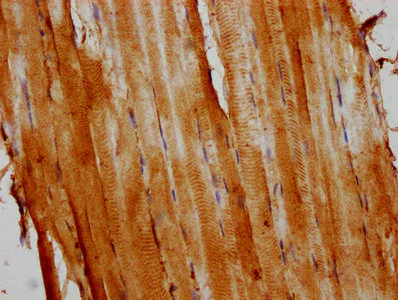 Immunohistochemistry (Formalin/PFA-fixed paraffin-embedded sections) - Anti-Alpha Skeletal Muscle Actin antibody - Cytoskeleton Marker (AB235928)