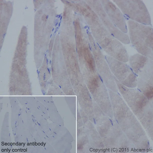 Immunohistochemistry (Formalin/PFA-fixed paraffin-embedded sections) - Anti-Alpha Skeletal Muscle Actin antibody [EPR18430] - BSA and Azide free (AB250775)