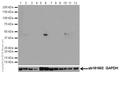 Western blot - Anti-Alpha Skeletal Muscle Actin antibody [EPR18430] - BSA and Azide free (AB250775)