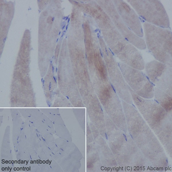 Immunohistochemistry (Formalin/PFA-fixed paraffin-embedded sections) - Anti-Alpha Skeletal Muscle Actin antibody [EPR18430] (AB184705), expandable thumbnail