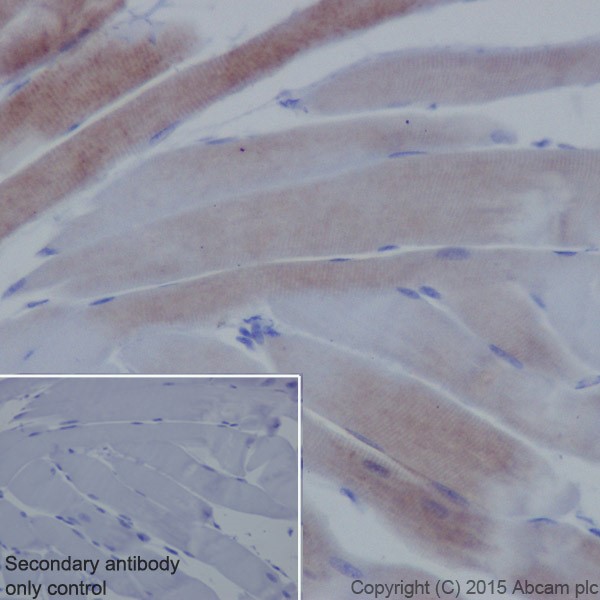 Immunohistochemistry (Formalin/PFA-fixed paraffin-embedded sections) - Anti-Alpha Skeletal Muscle Actin antibody [EPR18430] (AB184705), expandable thumbnail