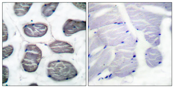 Immunohistochemistry (Formalin/PFA-fixed paraffin-embedded sections) - Anti-Alpha Skeletal Muscle Actin antibody - Loading Control (AB52218)