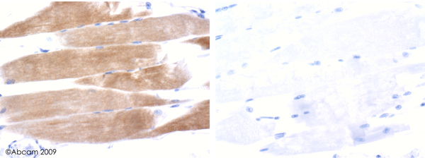 Immunohistochemistry (Formalin/PFA-fixed paraffin-embedded sections) - Anti-Alpha Skeletal Muscle Actin antibody (AB52218), expandable thumbnail