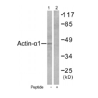 Western blot - Anti-Alpha Skeletal Muscle Actin antibody - Loading Control (AB52218), expandable thumbnail