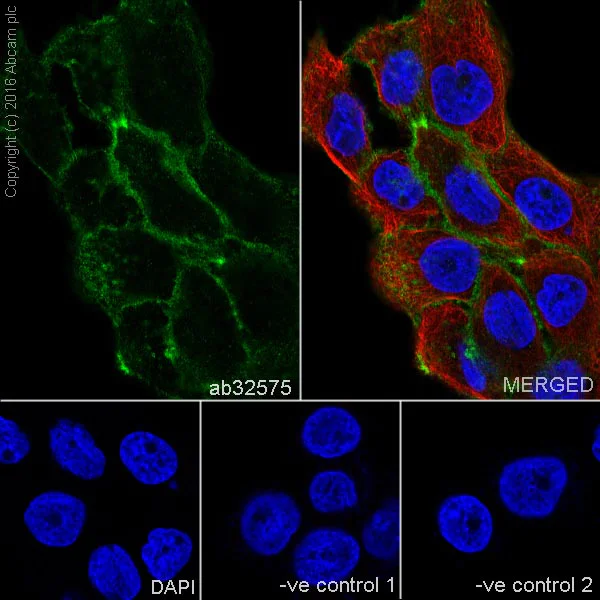 Immunocytochemistry/ Immunofluorescence - Anti-alpha smooth muscle Actin (acetyl E3) + ACTG2 (acetyl E3) antibody [E184] (AB32575)