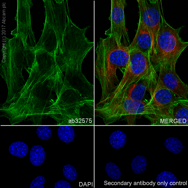 Immunocytochemistry/ Immunofluorescence - Anti-alpha smooth muscle Actin (acetyl E3) + ACTG2 (acetyl E3) antibody [E184] (AB32575), expandable thumbnail