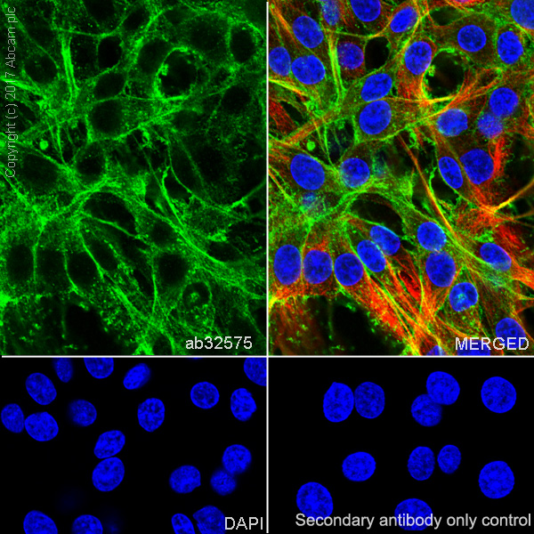 Immunocytochemistry/ Immunofluorescence - Anti-alpha smooth muscle Actin (acetyl E3) + ACTG2 (acetyl E3) antibody [E184] (AB32575), expandable thumbnail