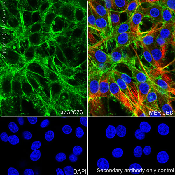 Immunocytochemistry/ Immunofluorescence - Anti-alpha smooth muscle Actin (acetyl E3) + ACTG2 (acetyl E3) antibody [E184] (AB32575)