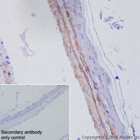 Immunohistochemistry (Formalin/PFA-fixed paraffin-embedded sections) - Anti-alpha smooth muscle Actin (acetyl E3) + ACTG2 (acetyl E3) antibody [E184] (ab32575), expandable thumbnail