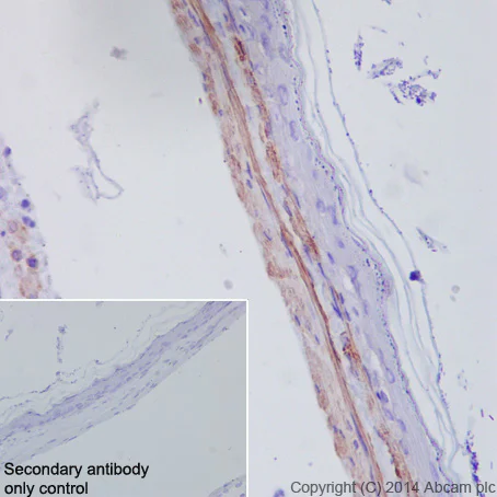 Immunohistochemistry (Formalin/PFA-fixed paraffin-embedded sections) - Anti-alpha smooth muscle Actin (acetyl E3) + ACTG2 (acetyl E3) antibody [E184] (AB32575)