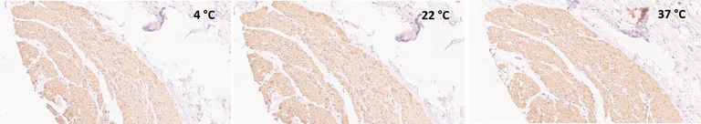 Immunohistochemistry (Formalin/PFA-fixed paraffin-embedded sections) - Anti-alpha smooth muscle Actin (acetyl E3) + ACTG2 (acetyl E3) antibody [E184] (AB32575)