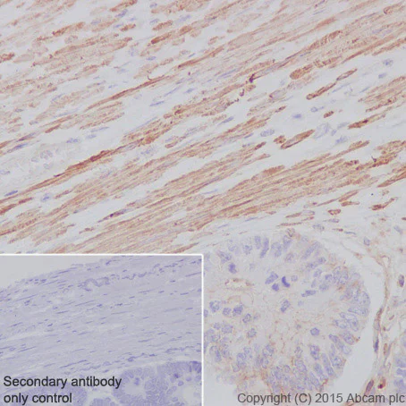 Immunohistochemistry (Formalin/PFA-fixed paraffin-embedded sections) - Anti-alpha smooth muscle Actin (acetyl E3) + ACTG2 (acetyl E3) antibody [E184] (AB32575)