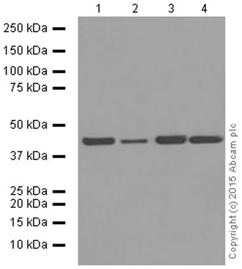 Western blot - Anti-alpha smooth muscle Actin (acetyl E3) + ACTG2 (acetyl E3) antibody [E184] (AB32575)