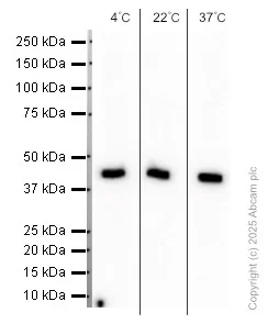 Western blot - Anti-alpha smooth muscle Actin (acetyl E3) + ACTG2 (acetyl E3) antibody [E184] (AB32575)