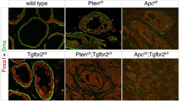 Immunohistochemistry (Formalin/PFA-fixed paraffin-embedded sections) - Anti-alpha smooth muscle Actin (acetyl E3) + ACTG2 (acetyl E3) antibody [E184] - BSA and Azide free (AB215368)
