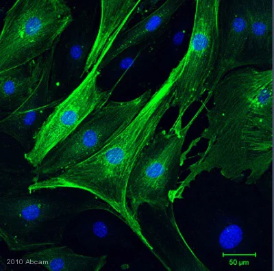 Immunocytochemistry/ Immunofluorescence - Anti-alpha smooth muscle Actin antibody [1A4] (AB7817)