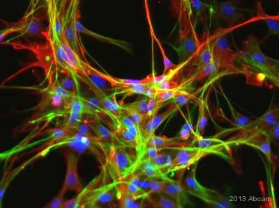 Immunocytochemistry/ Immunofluorescence - Anti-alpha smooth muscle Actin antibody [1A4] (AB7817)