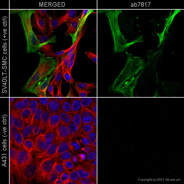 Immunocytochemistry/ Immunofluorescence - Anti-alpha smooth muscle Actin antibody [1A4] (AB7817)