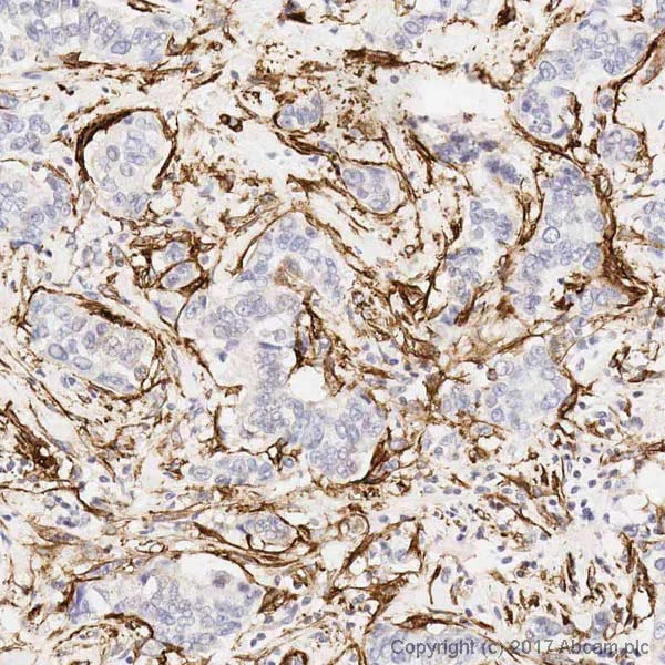 Immunohistochemistry (Formalin/PFA-fixed paraffin-embedded sections) - Anti-alpha smooth muscle Actin antibody [1A4] (AB7817)