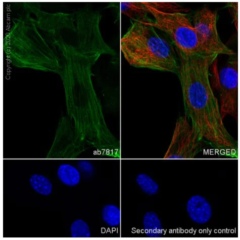 Immunocytochemistry/ Immunofluorescence - Anti-alpha smooth muscle Actin antibody [1A4] - BSA and Azide free (AB240654)