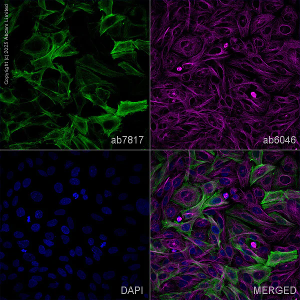 Immunocytochemistry/ Immunofluorescence - Anti-alpha smooth muscle Actin antibody [1A4] - BSA and Azide free (AB240654)