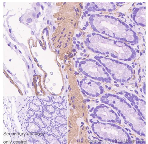 Immunohistochemistry (Formalin/PFA-fixed paraffin-embedded sections) - Anti-alpha smooth muscle Actin antibody [1A4] - BSA and Azide free (AB240654)