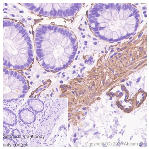 Immunohistochemistry (Formalin/PFA-fixed paraffin-embedded sections) - Anti-alpha smooth muscle Actin antibody [1A4] - BSA and Azide free (AB240654)