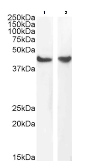 Western blot - Anti-alpha smooth muscle Actin antibody (AB21027)