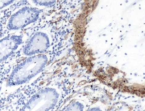 Immunohistochemistry (Formalin/PFA-fixed paraffin-embedded sections) - Anti-alpha smooth muscle Actin antibody (AB230458)