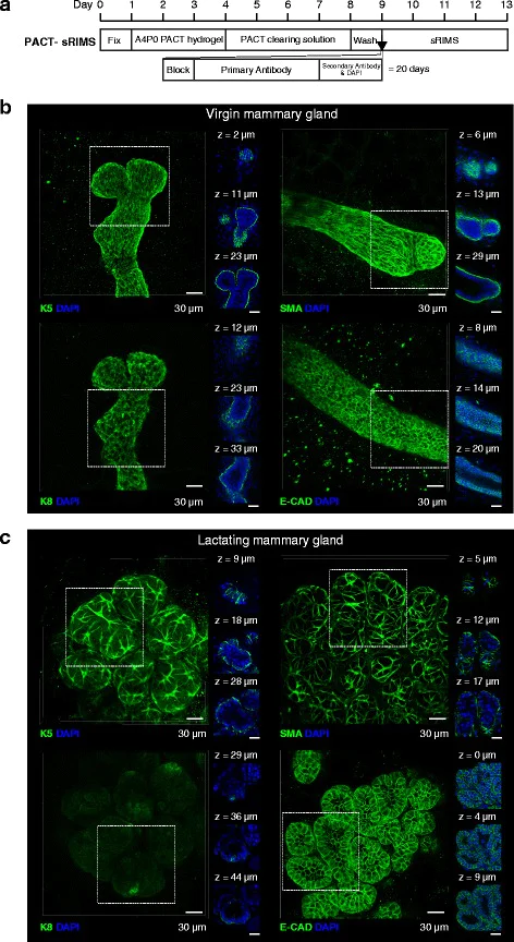 Immunohistochemistry (Formalin/PFA-fixed paraffin-embedded sections) - Anti-alpha smooth muscle Actin antibody (AB5694)