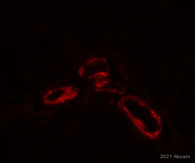 Immunohistochemistry (Formalin/PFA-fixed paraffin-embedded sections) - Anti-alpha smooth muscle Actin antibody (AB5694)