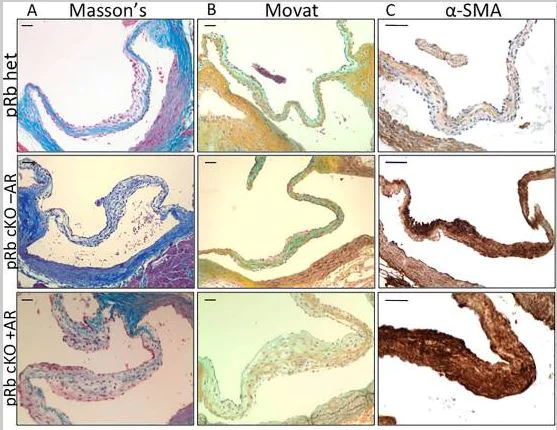 Immunohistochemistry (Formalin/PFA-fixed paraffin-embedded sections) - Anti-alpha smooth muscle Actin antibody (AB5694)
