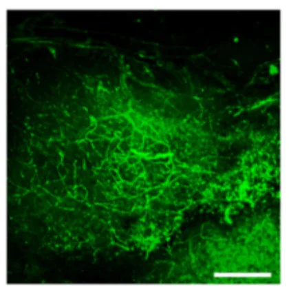 Immunohistochemistry (Formalin/PFA-fixed paraffin-embedded sections) - Anti-alpha smooth muscle Actin antibody (AB5694)