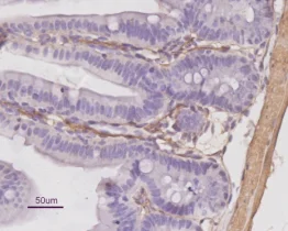 Immunohistochemistry (Formalin/PFA-fixed paraffin-embedded sections) - Anti-alpha smooth muscle Actin antibody (AB5694)
