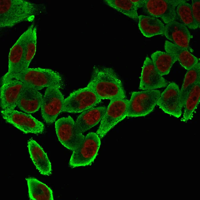 Immunocytochemistry - Anti-alpha smooth muscle Actin antibody [ACTA2/791] (AB220179)