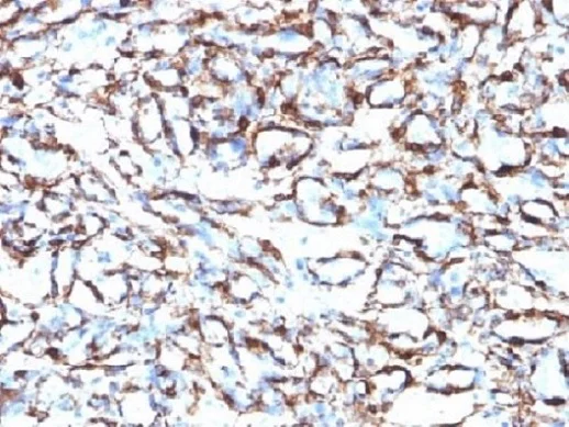 Immunohistochemistry (Formalin/PFA-fixed paraffin-embedded sections) - Anti-alpha smooth muscle Actin antibody [ACTA2/791] (AB220179)