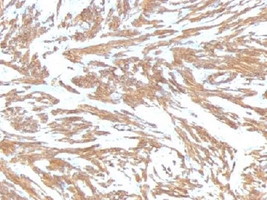 Immunohistochemistry (Formalin/PFA-fixed paraffin-embedded sections) - Anti-alpha smooth muscle Actin antibody [ACTA2/791] - BSA and Azide free (AB212795)