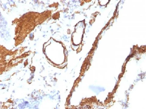 Immunohistochemistry (Formalin/PFA-fixed paraffin-embedded sections) - Anti-alpha smooth muscle Actin antibody [ACTA2/791] - BSA and Azide free (AB212795)