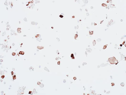 Immunocytochemistry - Anti-alpha smooth muscle Actin antibody [BLR082G] (AB265588)