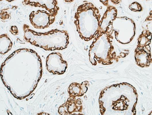 Immunohistochemistry (Formalin/PFA-fixed paraffin-embedded sections) - Anti-alpha smooth muscle Actin antibody [BLR082G] (AB265588)