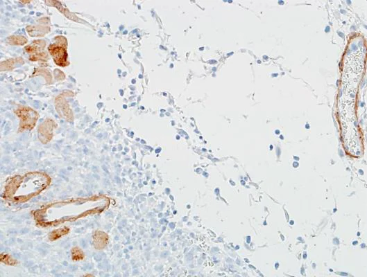 Immunohistochemistry (Formalin/PFA-fixed paraffin-embedded sections) - Anti-alpha smooth muscle Actin antibody [BLR082G] (AB265588)