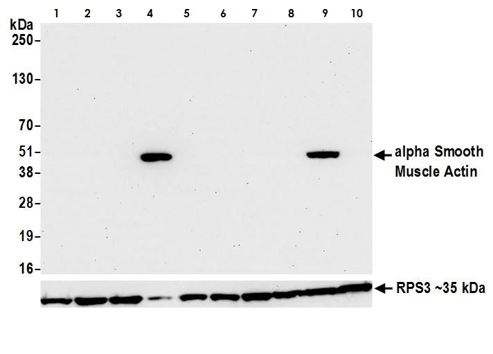 Western blot - Anti-alpha smooth muscle Actin antibody [BLR082G] (AB265588)